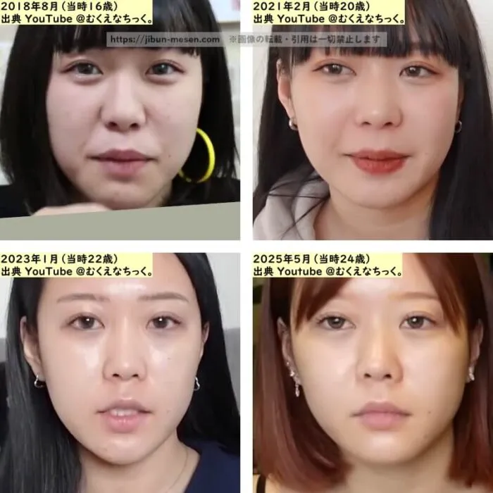 むくえな えなの鼻の整形検証2018年～2025年の画像