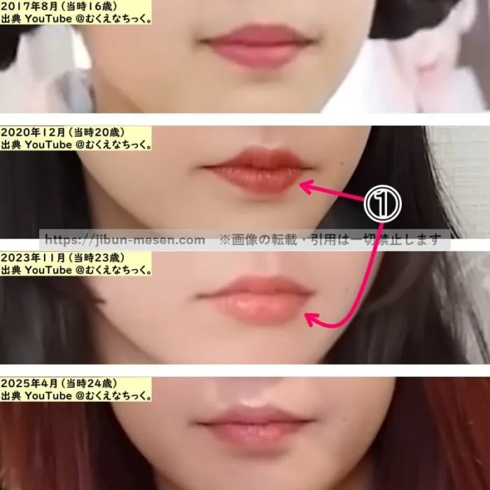 むくえな えなの唇の整形検証2017年～2025年（拡大）の画像