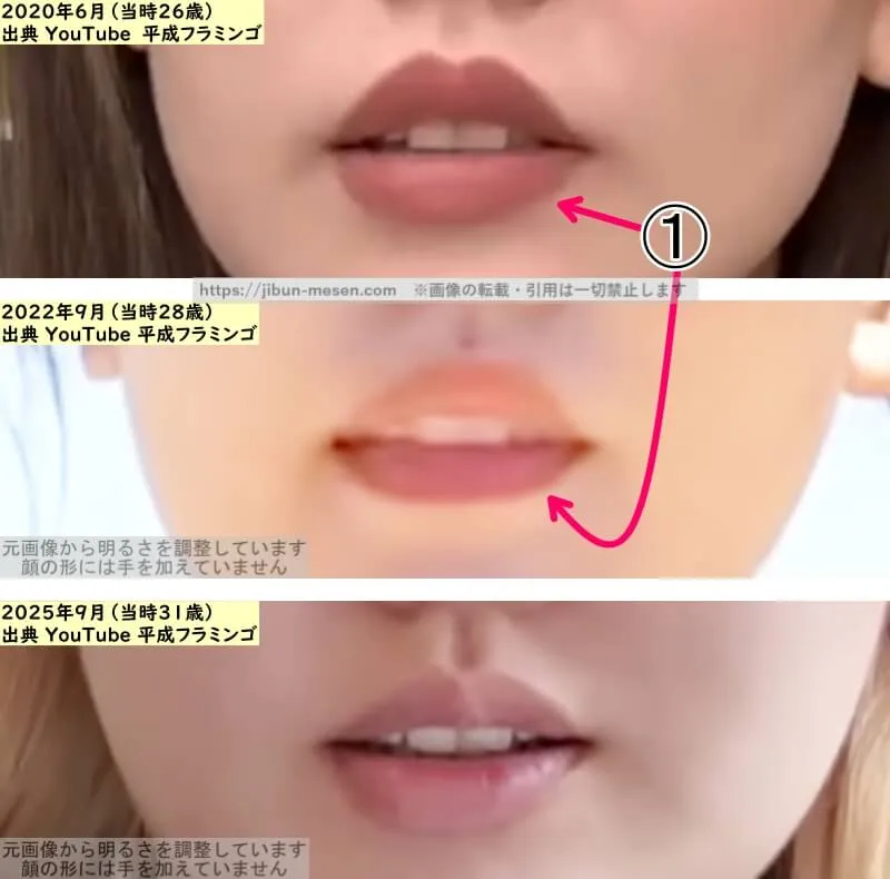 りほ（平成フラミンゴ）の唇の整形検証2020年～2025年（拡大）の画像