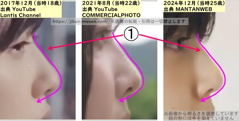 加藤小夏の鼻の整形検証2017年~2024年(横顔・拡大)の画像