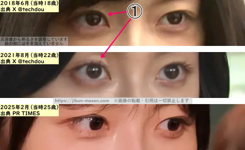 加藤小夏の目の整形検証2018年~2025年(拡大)の画像