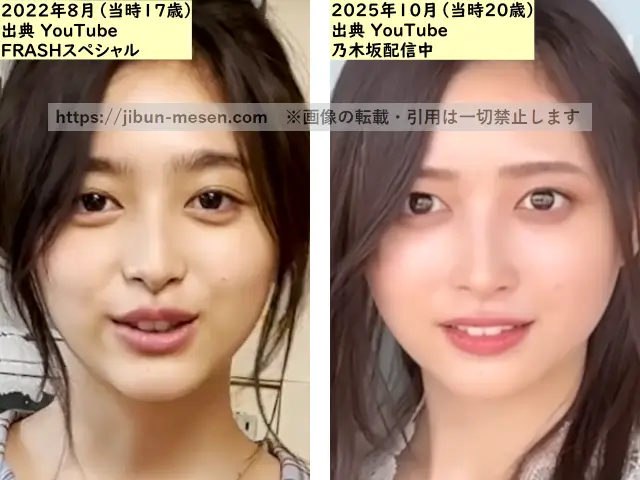 井上和の鼻の整形検証2022年~2025年の画像