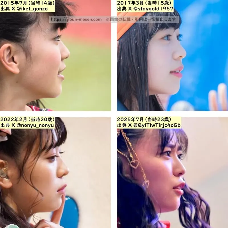 坂井仁香の鼻の整形検証2015年~2025年(横顔)