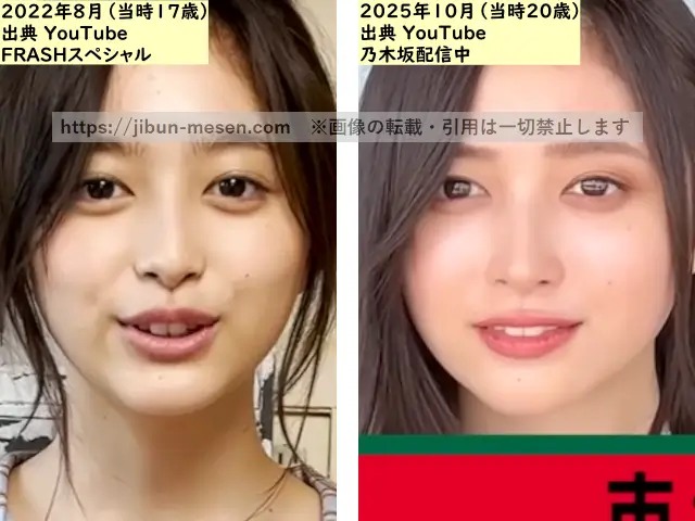 井上和の唇の整形検証2022年~2025年の画像