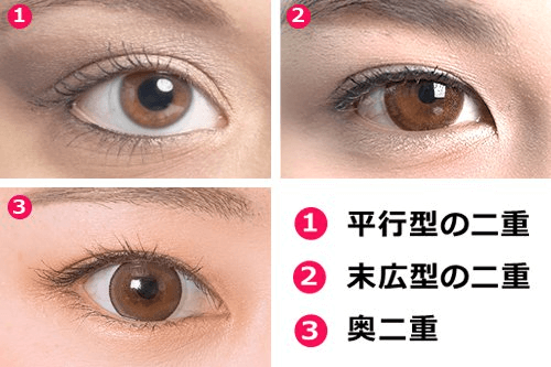 二重の種類の画像