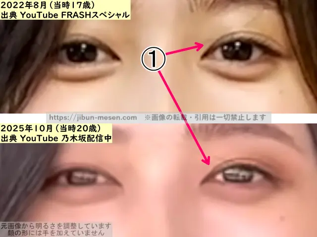 井上和の目の整形検証2022年~2025年(拡大)の画像