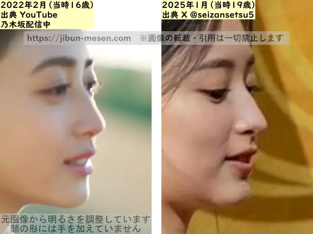 井上和の鼻の整形検証2022年~2025年(横顔)の画像