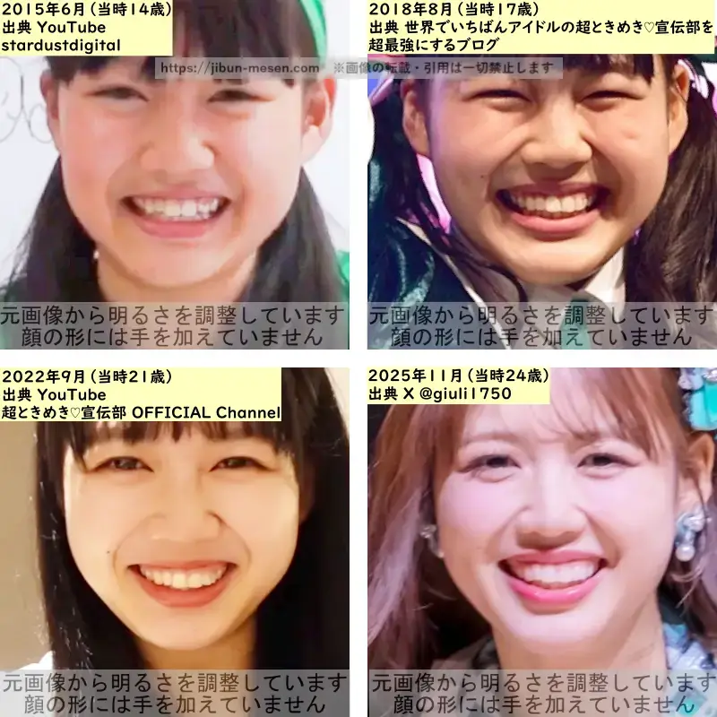 吉川ひよりの鼻の整形検証2015年~2025年の画像