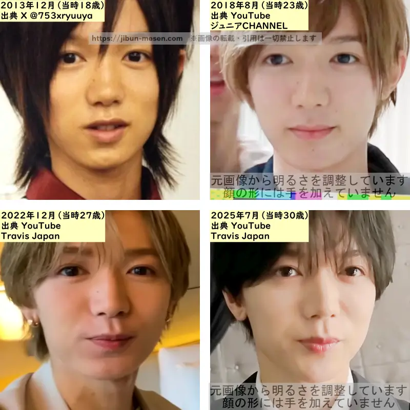 七五三掛龍也の鼻の整形検証2013年～2025年の画像