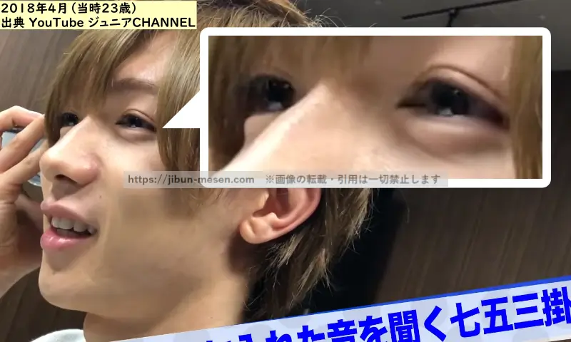 七五三掛龍也の二重の画像