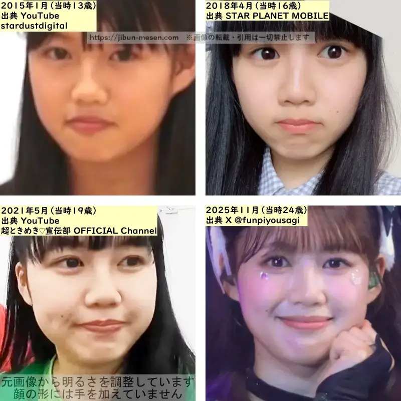 吉川ひよりの唇の整形検証2015年~2025年の画像