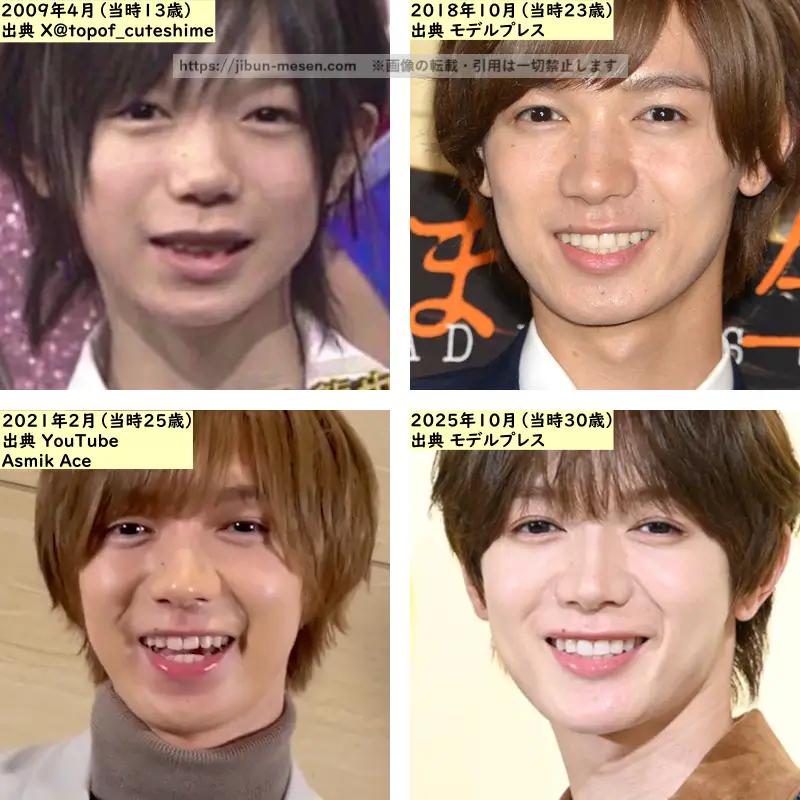 七五三掛龍也の目の整形検証2009年～2025年の画像