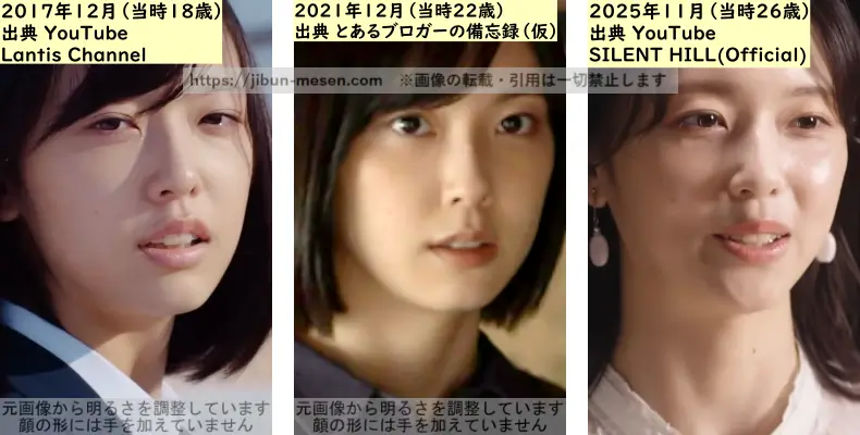 加藤小夏の唇の整形検証2017年~2025年の画像