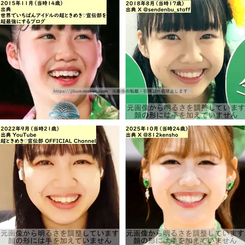 吉川ひよりの目の整形検証2015年~2025年の画像