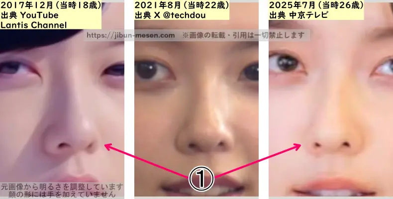 加藤小夏の鼻の整形検証2017年~2025年(拡大)の画像