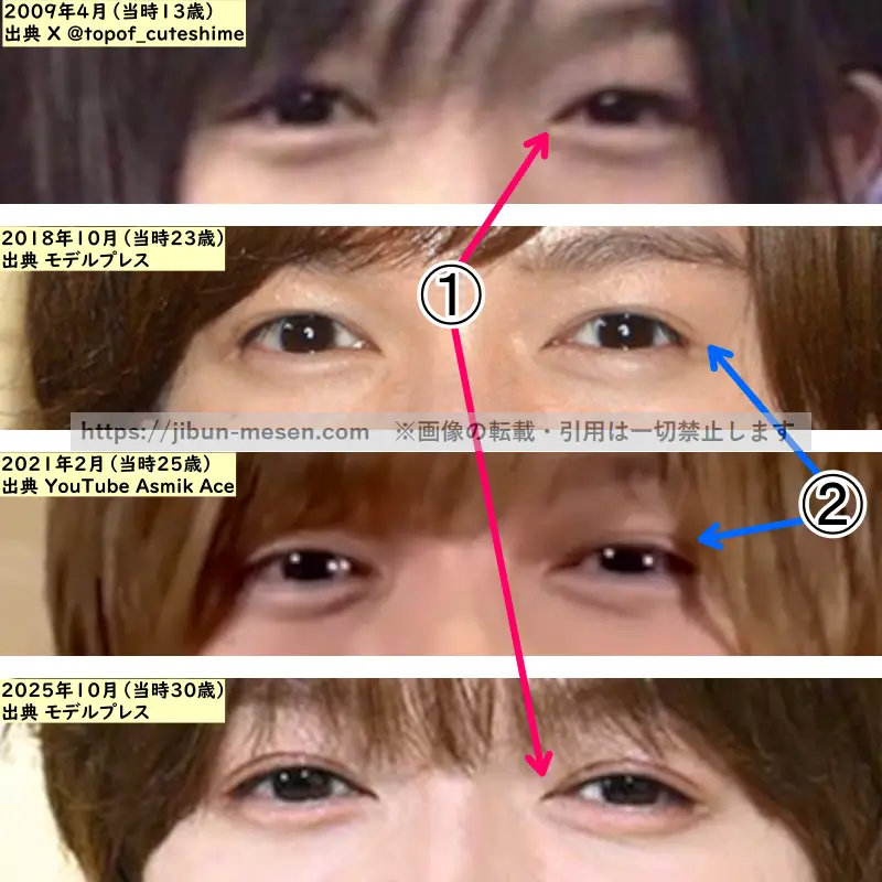 七五三掛龍也の目の整形検証2009年～2025年（拡大）の画像