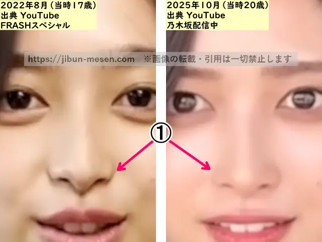 井上和の鼻の整形検証2022年~2025年(拡大)の画像