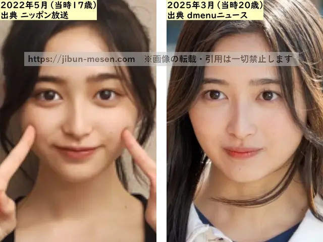 井上和の肌の整形検証2022年~2025年の画像