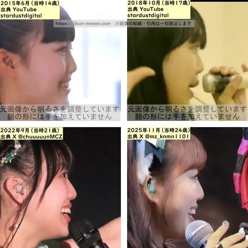 吉川ひよりの鼻の整形検証2015年~2025年(横顔)の画像