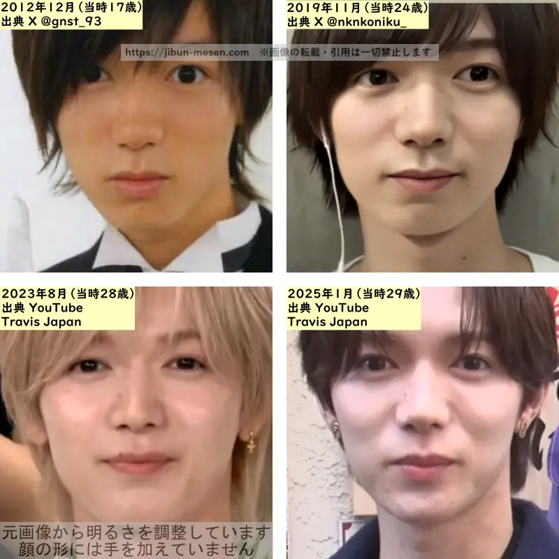 七五三掛龍也の唇の整形検証2012年～2025年の画像