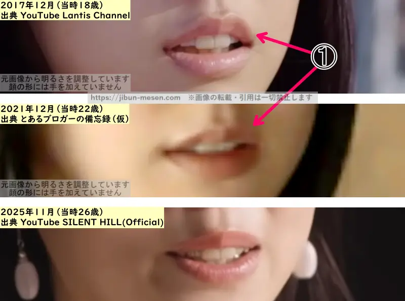 加藤小夏の唇の整形検証2017年~2025年(拡大)の画像