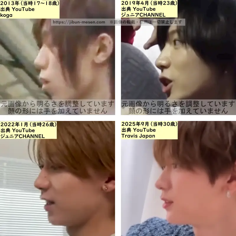 七五三掛龍也の鼻の整形検証2013年～2025年（横顔）の画像