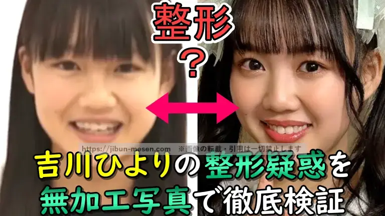 吉川ひよりの整形疑惑を 無加工写真で徹底検証