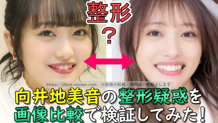向井地美音の整形疑惑を 画像比較で検証してみた！