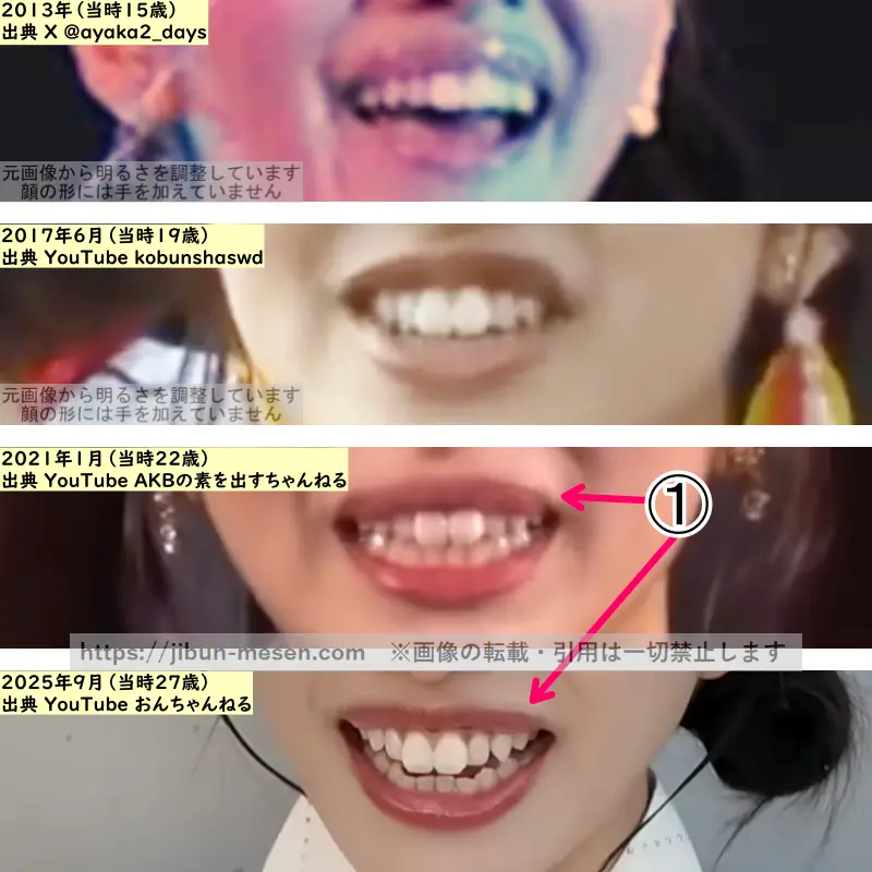 向井地美音の唇の整形検証2013年~2025年の画像