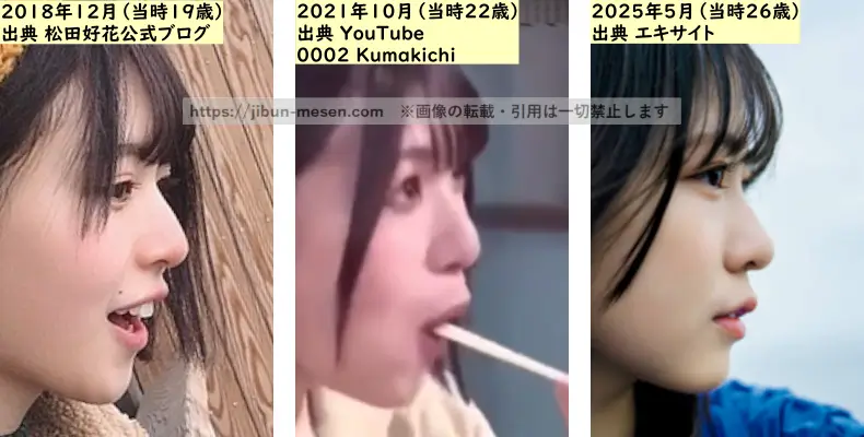 松田好花の鼻の整形検証2018年～2025年（横顔）の画像