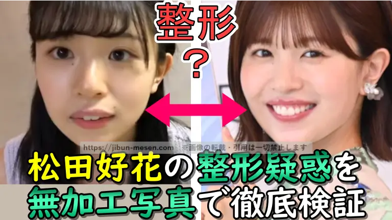 松田好花の整形疑惑を 無加工写真で徹底検証