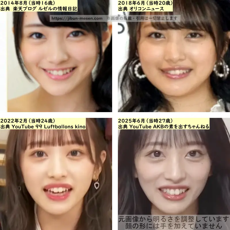 向井地美音の鼻の整形検証2014年~2025年の画像