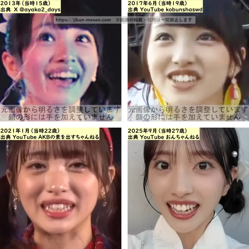 向井地美音の唇の整形検証2013年~2025年の画像