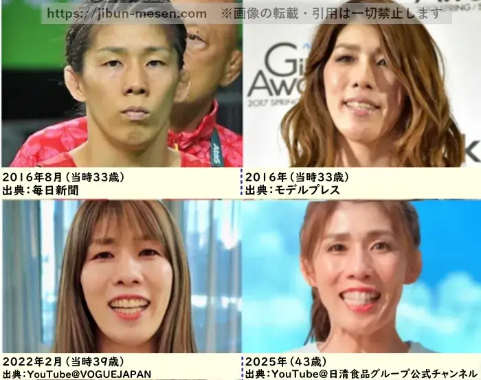 吉田沙保里の顔の整形検証2016年～2025年（メイク）の画像