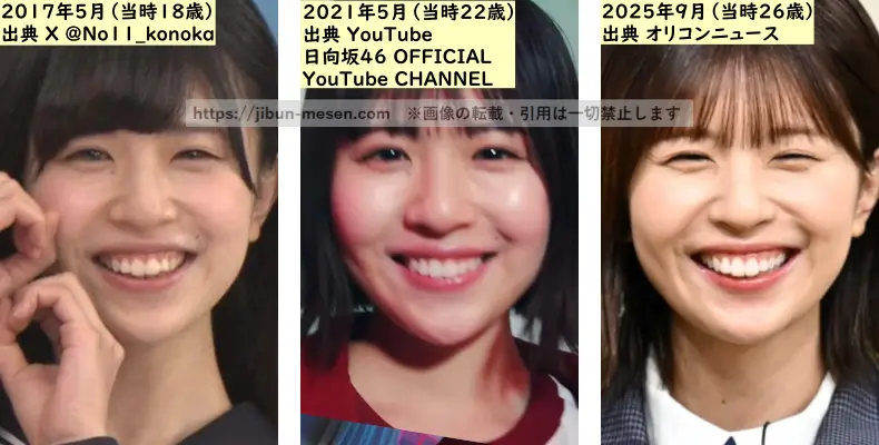 松田好花の鼻の整形検証2017年～2025年の画像