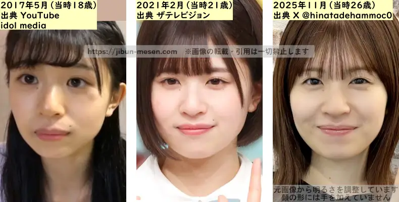 松田好花の唇の整形検証2017年～2025年の画像