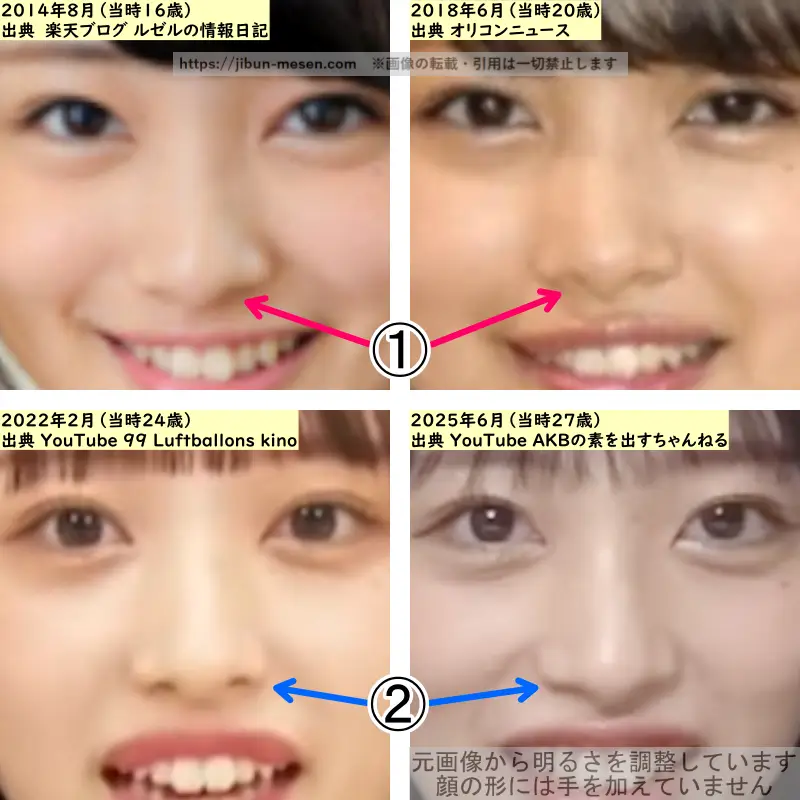 向井地美音の鼻の整形検証2014年~2025年(拡大)の画像