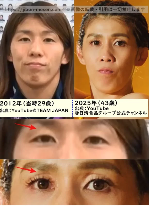 吉田沙保里の目の整形検証2012年～2025年の画像