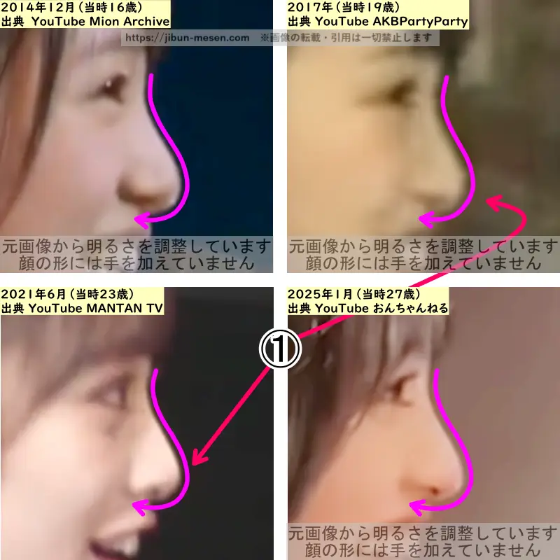 向井地美音の鼻の整形検証2014年~2025年(横顔・拡大)の画像