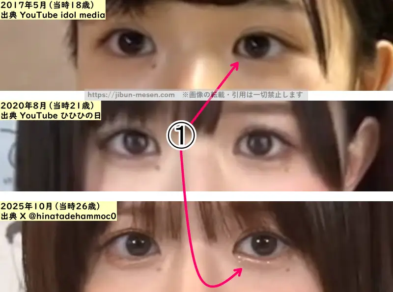 松田好花の目の整形検証2017年～2025年（拡大）の画像