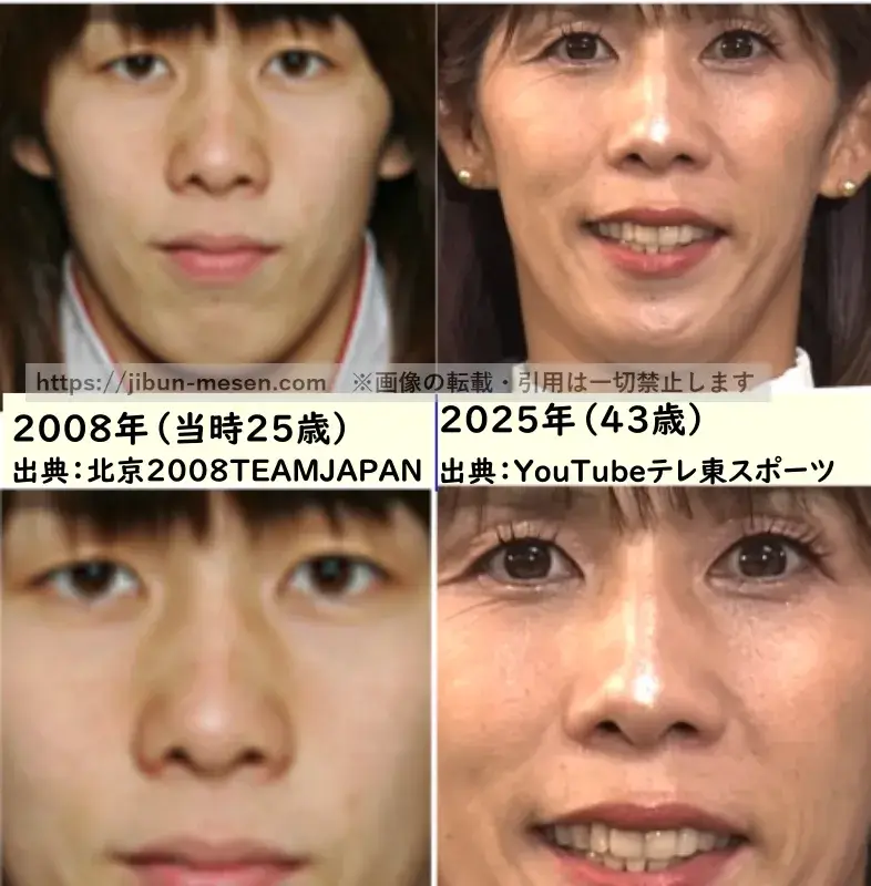 吉田沙保里の鼻の整形検証2008年～2025年の画像