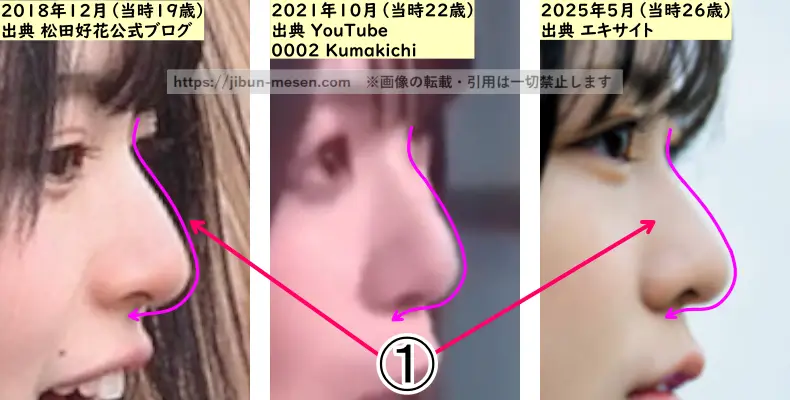 松田好花の鼻の整形検証2018年～2025年（横顔・拡大）の画像