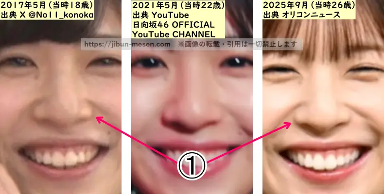 松田好花の鼻の整形検証2017年～2025年（拡大）の画像