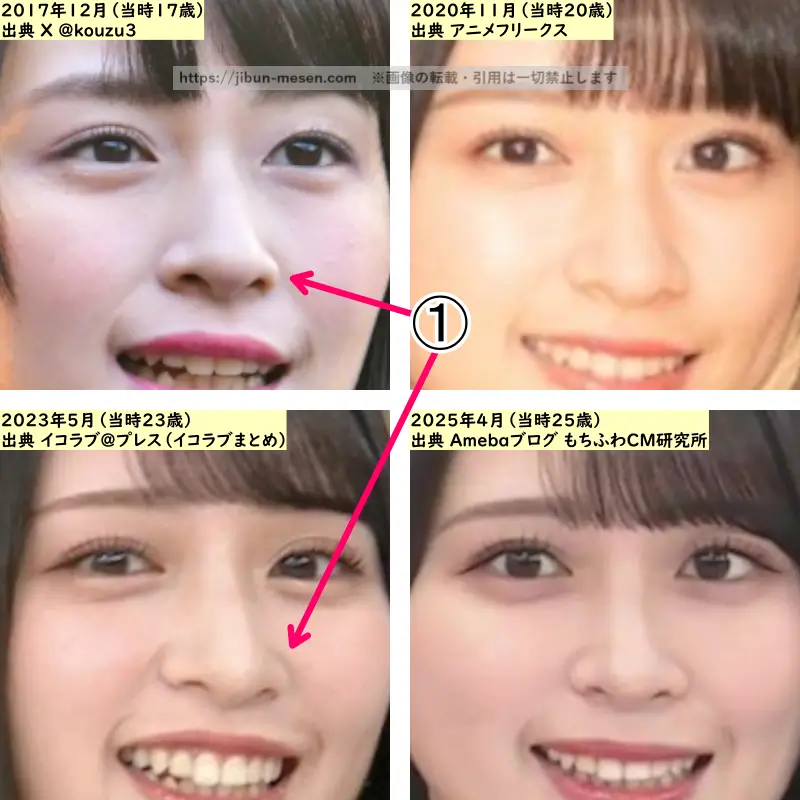 佐々木舞香の鼻の整形検証2017年~2025年(拡大)の画像