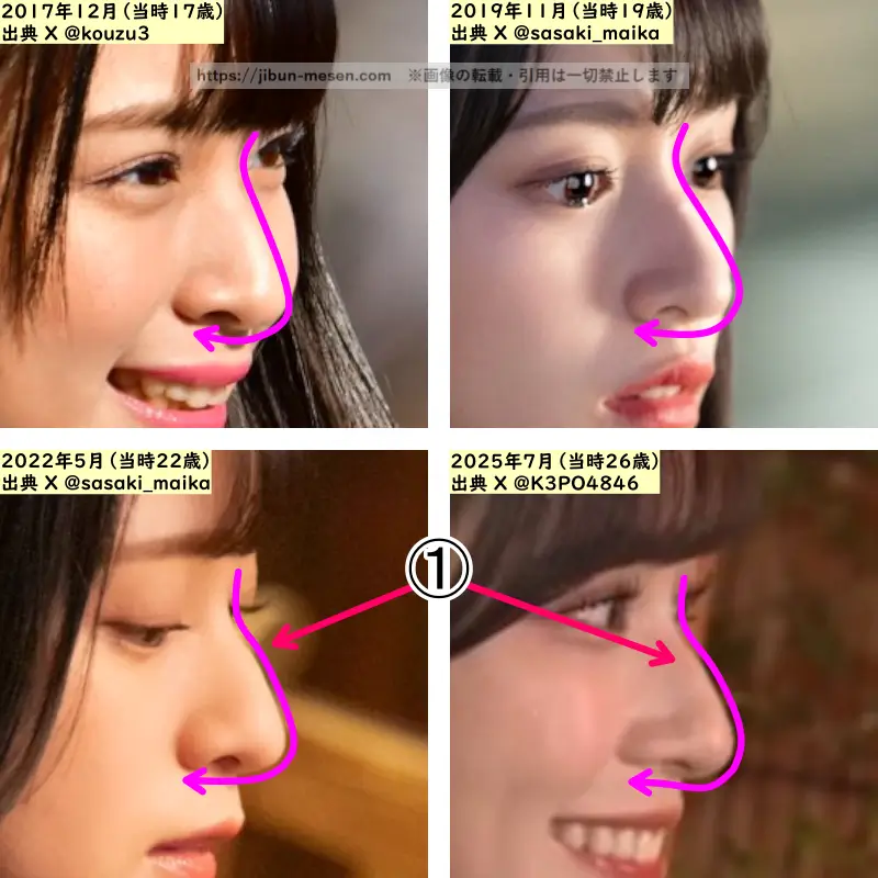 佐々木舞香の鼻の整形検証2017年~2025年(横顔・拡大)の画像