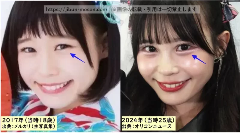 村川緋杏の涙袋の検証2017年~2024年の画像