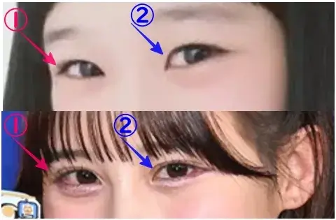 村川緋杏の目の整形検証2018年~2025年(拡大)の画像