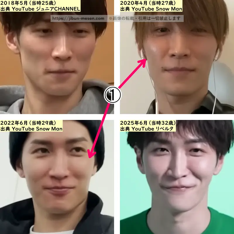 渡辺翔太の顔の整形検証2018年～2025年の画像