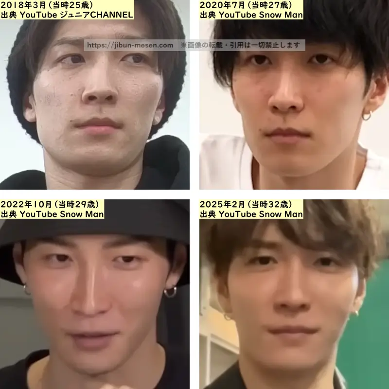 渡辺翔太の唇の整形検証2018年～2025年の画像