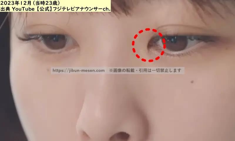 原田葵の蒙古ひだの画像